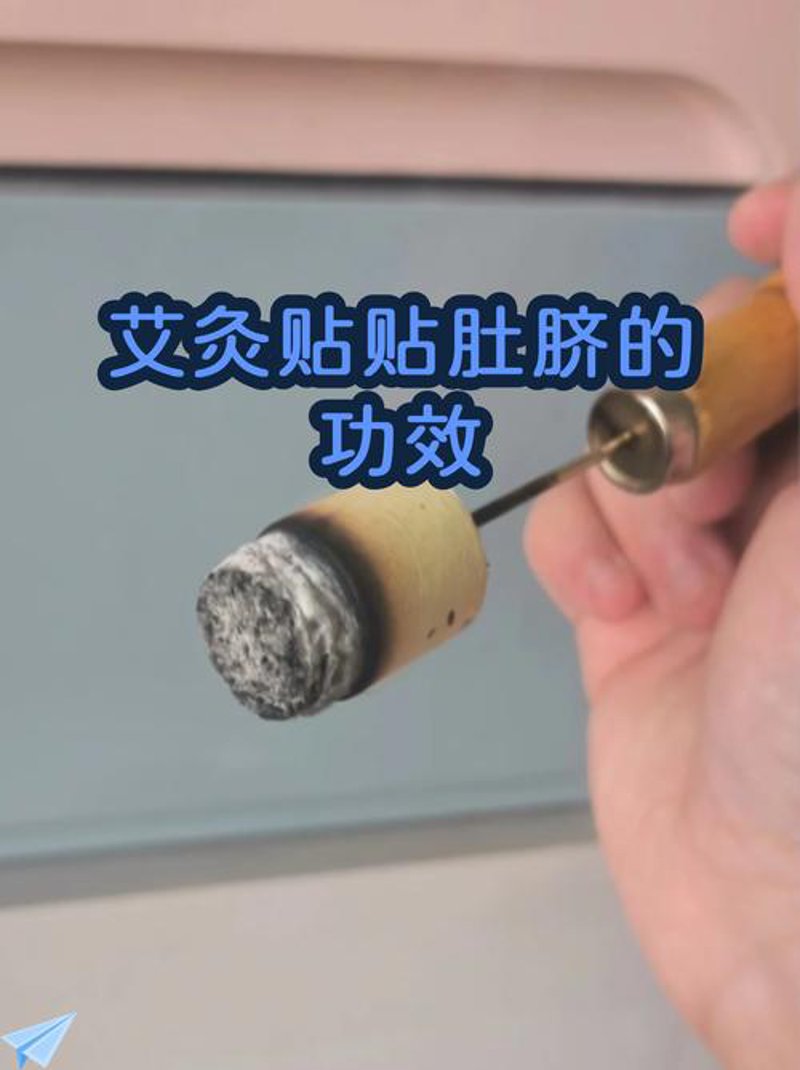 艾灸贴：中医文化与现代生活的完美融合